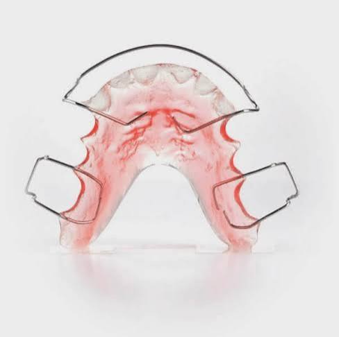 Classic Hawley retainer with metal wire and acrylic palate piece